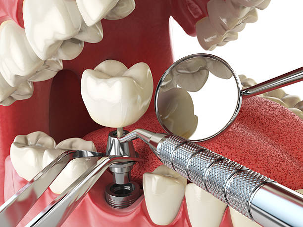 Best Emergency Treatment for Toothache in Rutgers University Livingston Campus, NJ