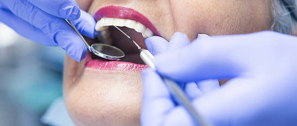 Best Emergency Tooth Extraction in Rutgers University Livingston Campus, NJ